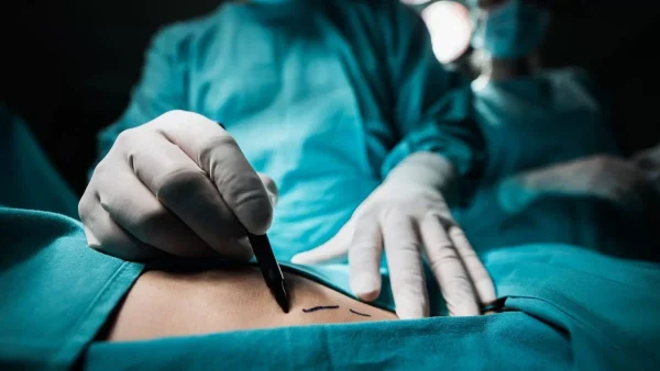 Αεροσυνοδός καταθέτει αγωγή σε γνωστό Έλληνα πλαστικό χειρουργό