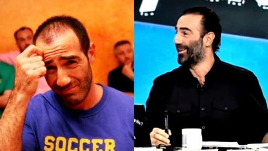 Αντώνης Κανάκης πριν την εμφύτευση 