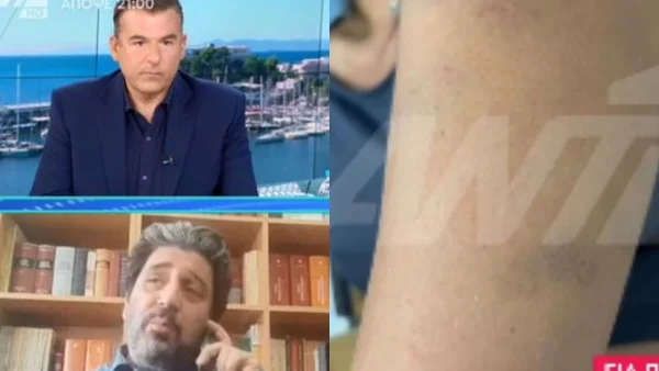 Άγριος ξυλοδαρμός εγκυμονούσας από τον πολύ γνωστό επιχειρηματία σύντροφό της - Μεταφέρθηκε με σπασμούς από ομάδα ΔΙΑΣ στον 9ο μήνα κύησης